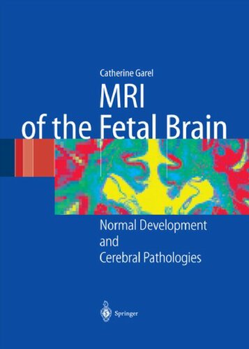 Mri of the fetal brain : normal development and cerebral pathologies.