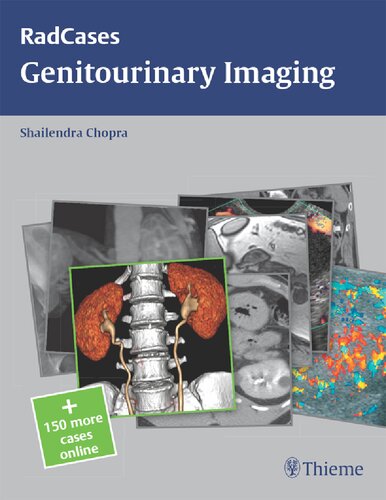 Radcases genitourinary imaging