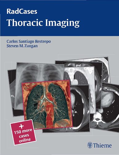 RadCases thoracic imaging