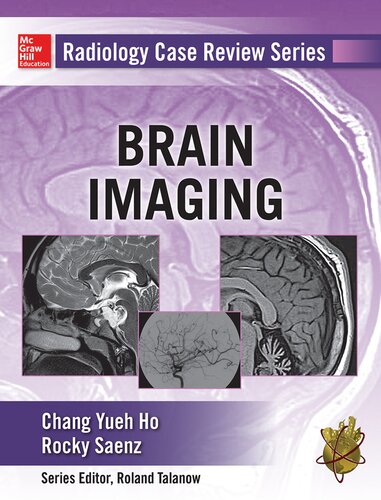 Brain imaging