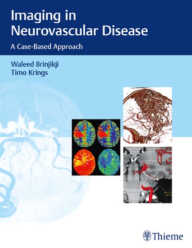 Imaging in Neurovascular Disease: A Case-Based Approach