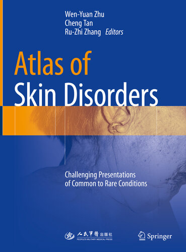 Atlas of Skin Disorders: Challenging Presentations of Common to Rare Conditions