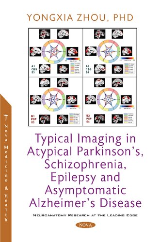 Typical imaging in atypical Parkinson's, schizophrenia, epilepsy and asymptomatic Alzheimer's disease