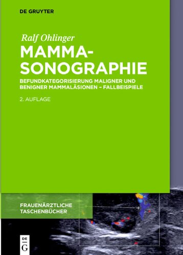 Mammasonographie (Frauenarztliche Taschenbucher) (German Edition) (Frauenärztliche Taschenbücher)