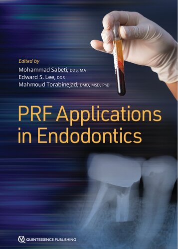 PRF applications in Endodontics