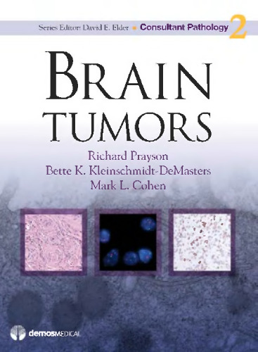 Brain Tumors: Leaving the Garden of Eden--A Survival Guide to Diagnosis, Learning the Basics, Getting Organized, and Finding Your Medical Team