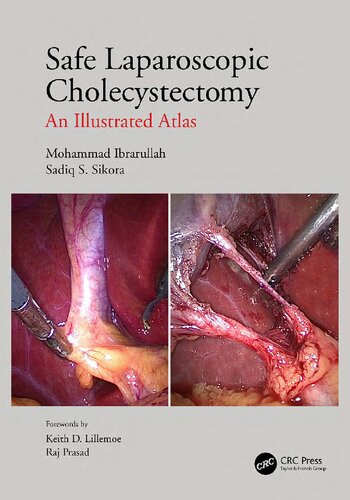 Safe Laparoscopic Cholecystectomy: An Illustrated Atlas