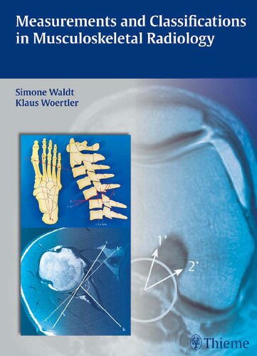 Measurements and Classifications in Musculoskeletal Radiology