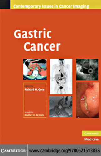 Gastric Cancer (Contemporary Issues in Cancer Imaging)