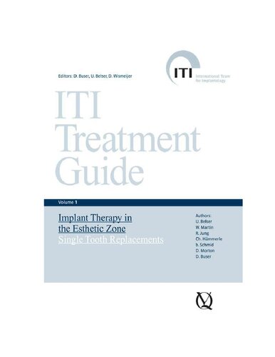 ITI treatment guide, Vol 1: Implant Therapy in the Esthetic Zone: Single-Tooth Replacements