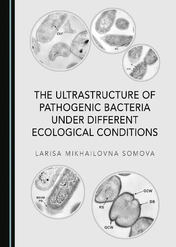 The Ultrastructure of Pathogenic Bacteria Under Different Ecological Conditions