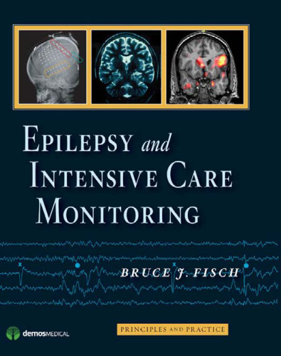 Epilepsy and Intensive Care Monitoring: Principles and Practice