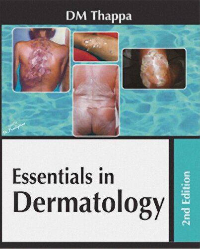 Essentials in Dermatology