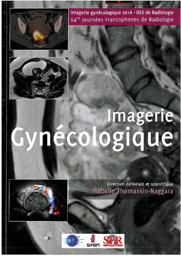 Syllabus Imagerie Gynécologique