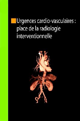 Urgences cardio-vasculaires : place de la radiologie interventionnelle: Congrès des JFICV – Lille 2009 (Collection de la Société française d’imagerie cardiaque et vasculaire) (French Edition)