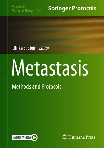 Metastasis: Methods and Protocols