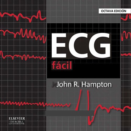 The ECG Made Easy