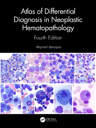 Atlas of Differential Diagnosis in Neoplastic Hematopathology