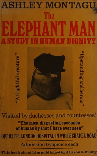 The Elephant Man