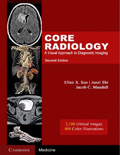 Core radiology : A Visual Approach To Diagnostic Imaging