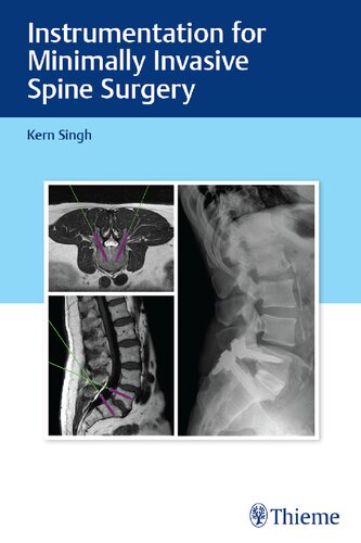 Instrumentation for Minimally Invasive Spine Surgery