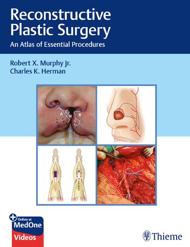 Reconstructive Plastic Surgery: An Atlas of Essential Procedures