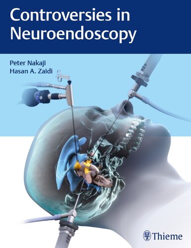 Controversies in Neuroendoscopy