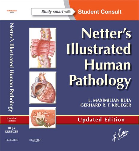 Netter's Illustrated Human Pathology