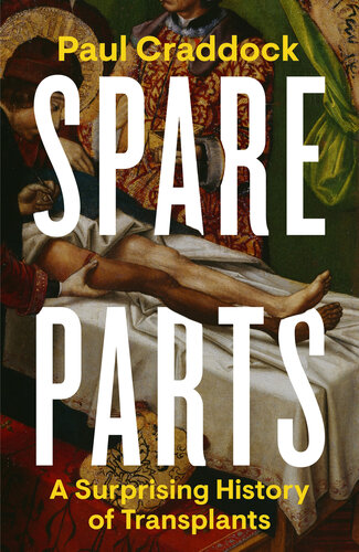 Spare Parts: An Unexpected History of Transplants