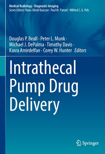 Intrathecal Pump Drug Delivery