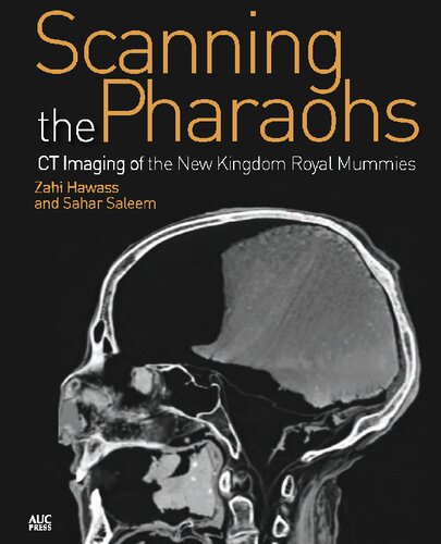 Scanning the Pharaohs: CT Imaging of the New Kingdom Royal Mummies