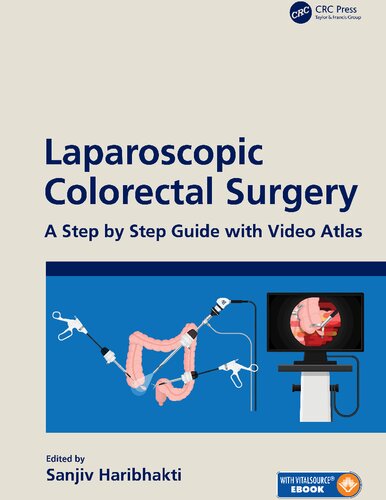 Laparoscopic Colorectal Surgery: A Step by Step Guide with Video Atlas