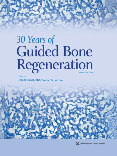 30 Years of Guided Bone Regeneration