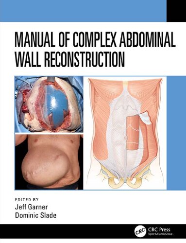 Manual of Complex Abdominal Wall Reconstruction