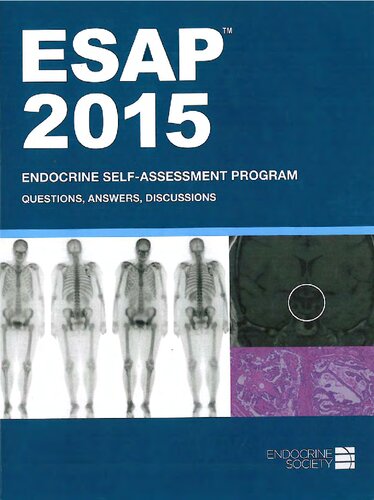 ESAP™ 2015 Endocrine Self-Assessment Program Questions&Answers Discussions Endocrine Society