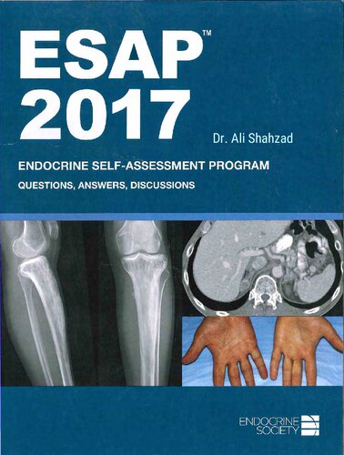 ESAP™ 2017 Endocrine Self-Assessment Program Questions&Answers Discussions Endocrine Society