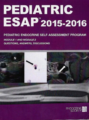 Pediatric ESAP™ 2015-2016 ESAP™ Endocrine Self-Assessment Program Questions&Answers Discussions Endocrine Society