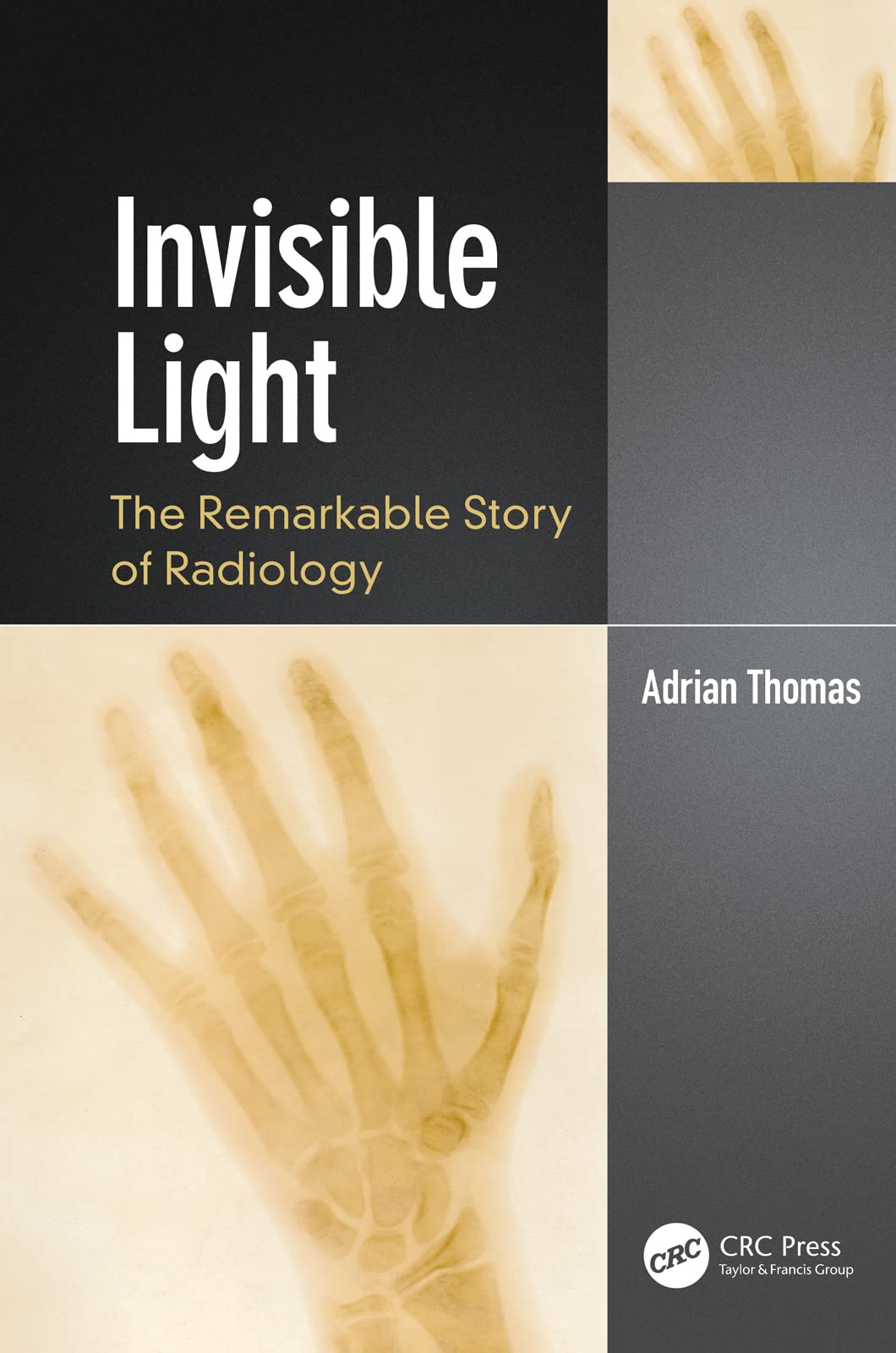 Invisible Light: The Remarkable Story of Radiology