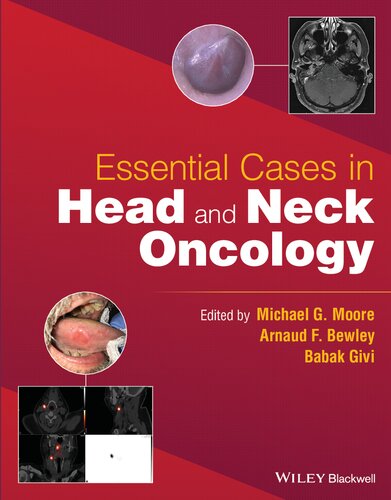 Essential Cases in Head and Neck Oncology