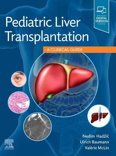 Pediatric Liver Transplantation: A Clinical Guide