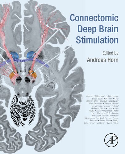 Connectomic Deep Brain Stimulation