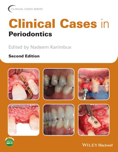 CLINICAL CASES IN PERIODONTICS.