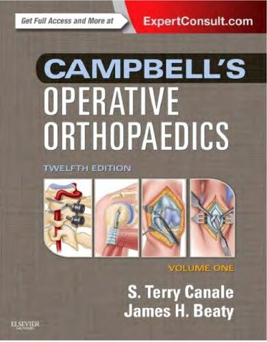 Campbell’s Operative Orthopaedics 4-Volume Set (S. Terry Canale, James H. Beaty) (z-lib.org) copy