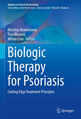 Biologic Therapy for Psoriasis: Cutting Edge Treatment Principles