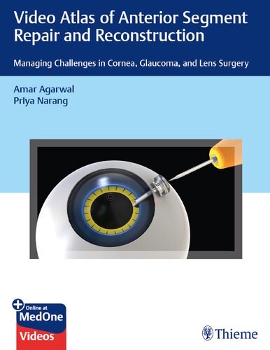 Video Atlas of Anterior Segment Repair and  Reconstruction:  Managing Challenges in Cornea, Glaucoma, and Lens Surgery