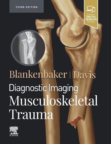 Diagnostic Imaging: Musculoskeletal Trauma