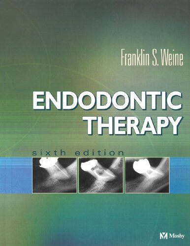 Endodontic Therapy