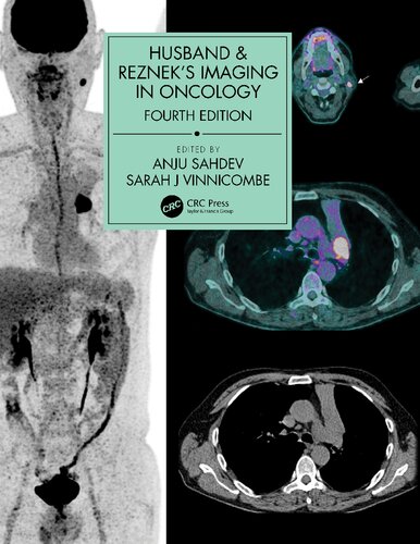 Husband & Reznek's Imaging in Oncology