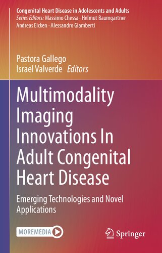 Multimodality Imaging Innovations In Adult Congenital Heart Disease : Emerging Technologies and Novel Applications