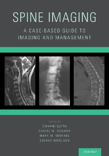 Spine Imaging: A Case-Based Guide to Imaging and Management